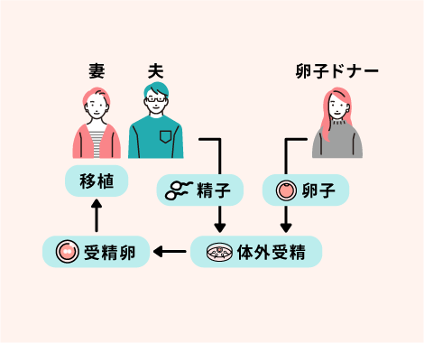 卵子提供とは？かんたん解説